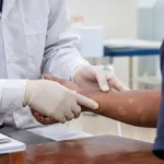Dois casos de hanseníase levam Porto Velho a reforçar busca ativa em Rio Pardo Hanseníase em Rio Pardo leva equipes de saúde a reforçar busca ativa