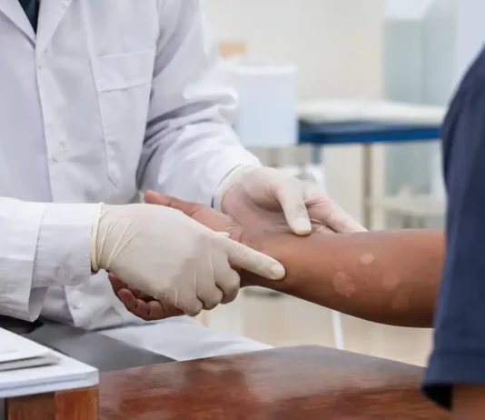 Dois casos de hanseníase levam Porto Velho a reforçar busca ativa em Rio Pardo Hanseníase em Rio Pardo leva equipes de saúde a reforçar busca ativa