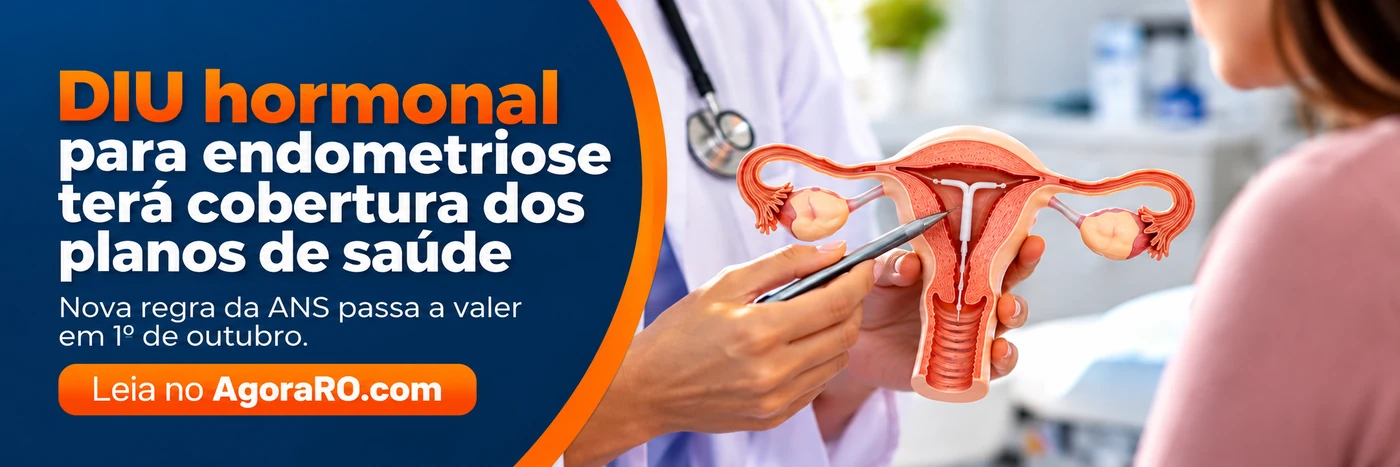 DIU para endometriose terá cobertura dos planos conforme critérios da ANS