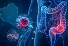 Anvisa aprova novo tratamento para câncer colorretal metastático Tratamento para câncer colorretal representado por cólon, células tumorais e vasos sanguíneos